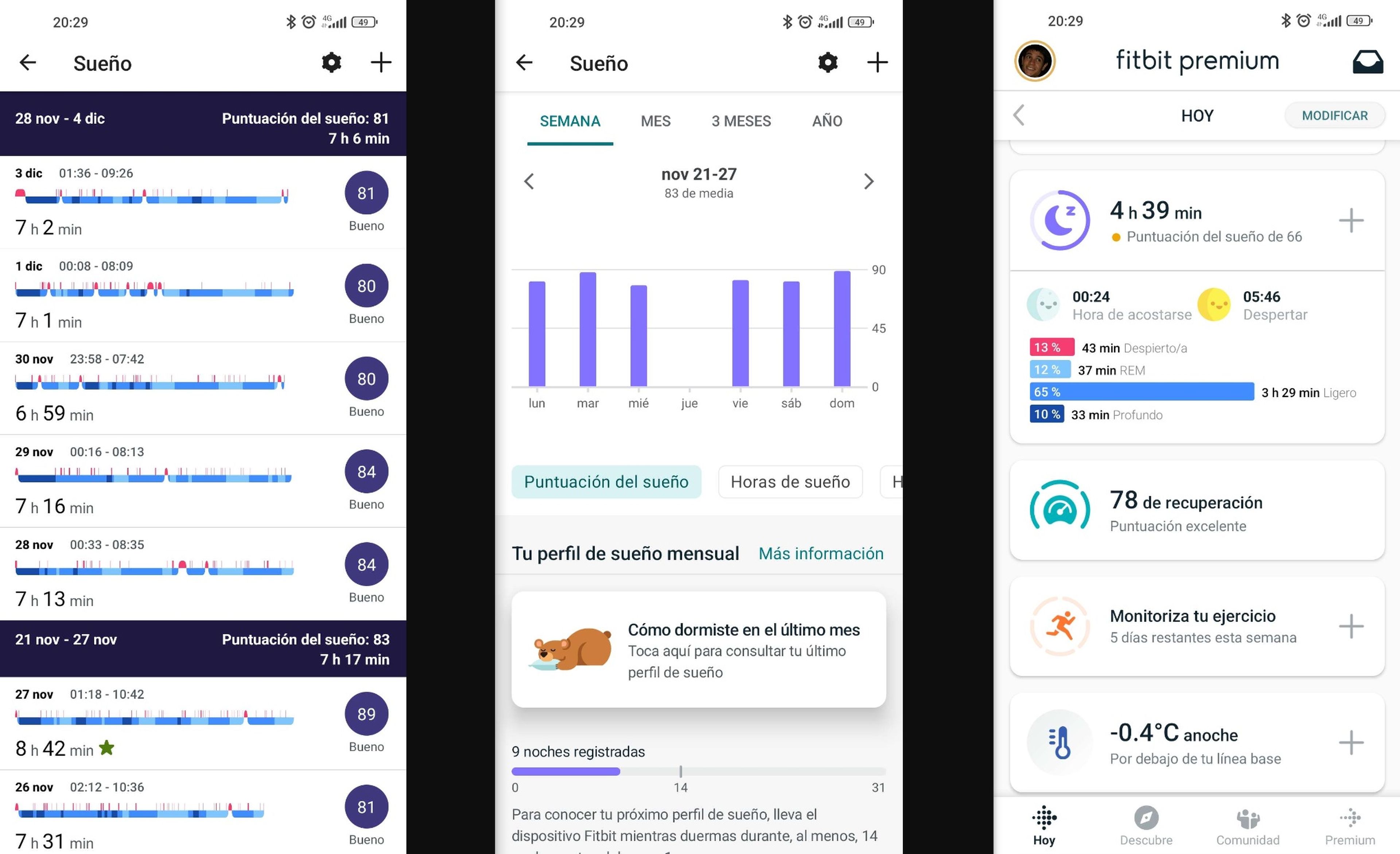 Fitbit Sense 2