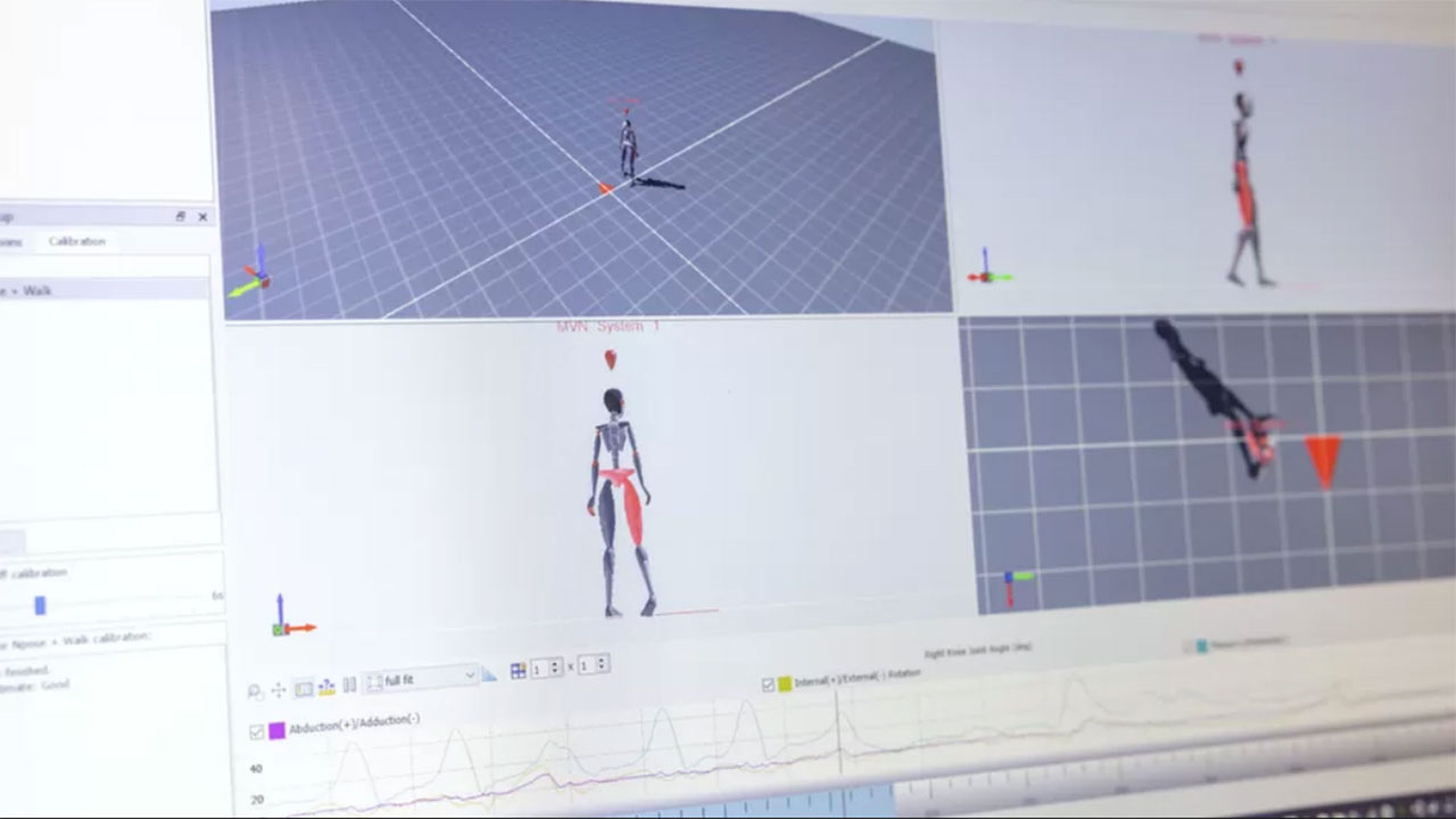 Utilizan la tecnología de inteligencia artificial de Avatar para rastrear enfermedades